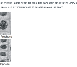 Root onion mitosis lab tip cells cell cycle