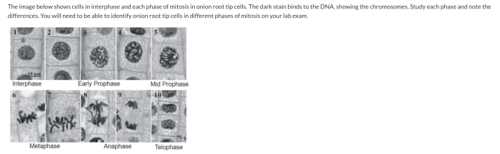 Root onion mitosis lab tip cells cell cycle